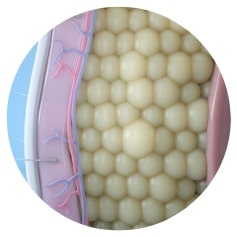 Fat cells before CoolSculpting.