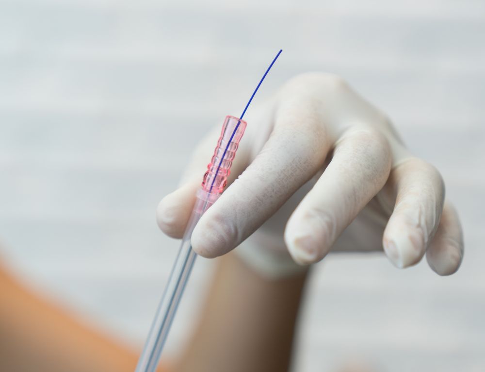 A gloved hand holding a barbed PDO thread to show the difference between smooth and barbed PDO threads in Colorado.