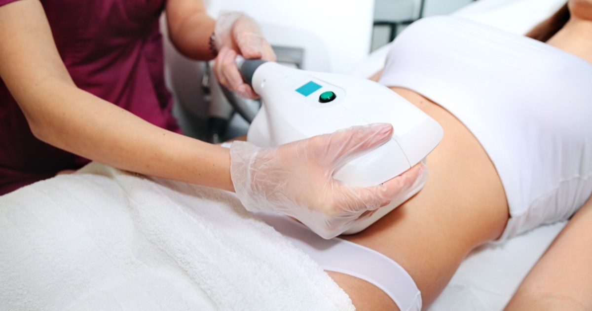 someone getting coolsculpting.